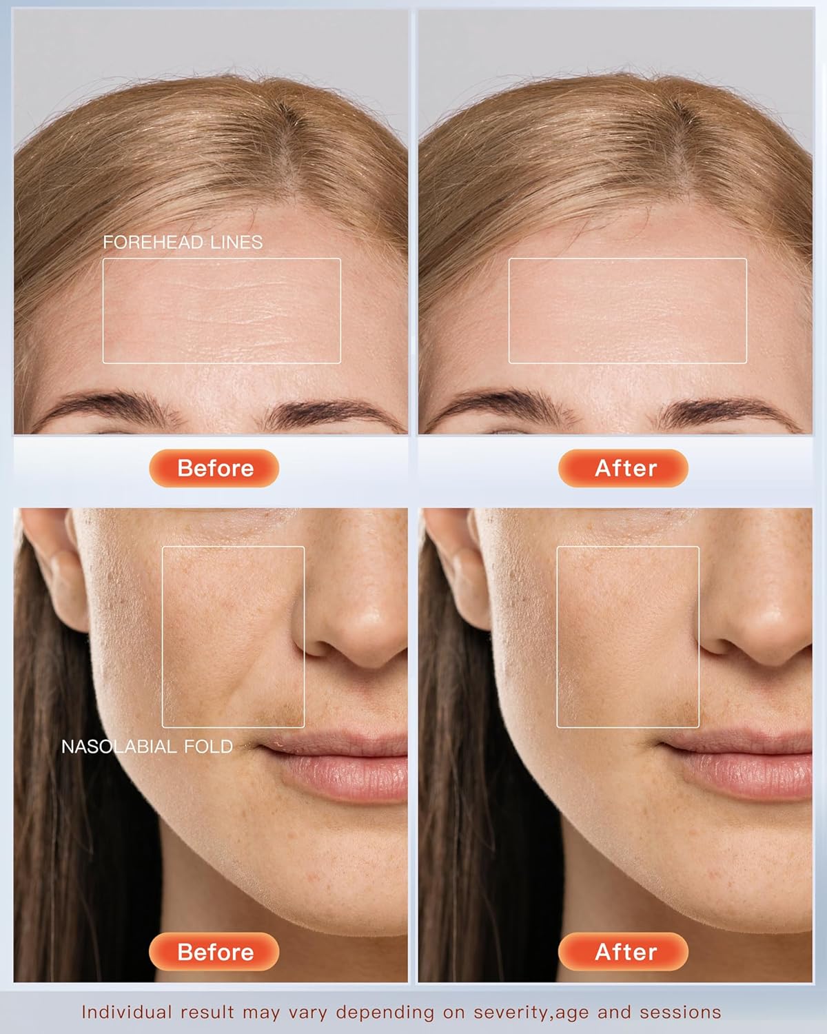 NEWKEY LED Face Mask Light Therapy