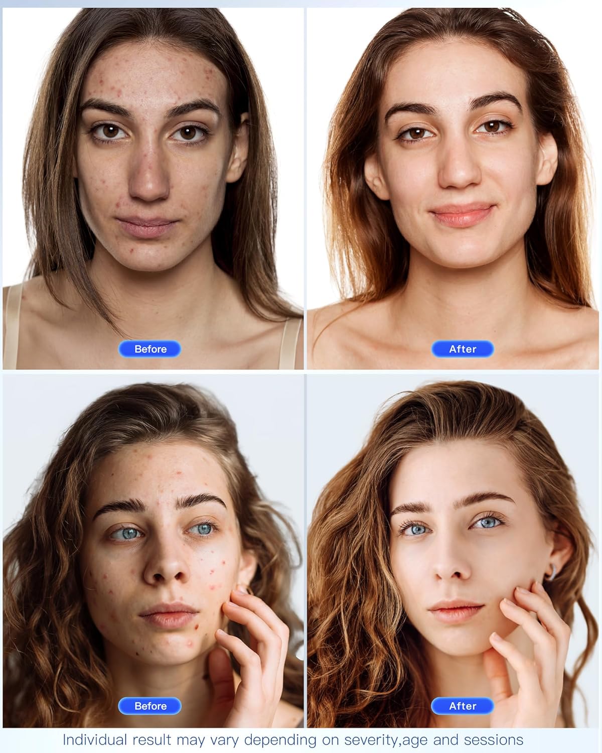 NEWKEY LED Face Mask Light Therapy